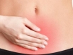 Nhận biết dấu hiệu điển hình của ung thư cổ tử cung giai đoạn 2